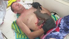 Köpek Balığı Tarafından Isırılan Adamın Kurtarılması