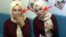 Gelin Adayı Hanife’nin Yüzünde Merak Uyandıran Morluk