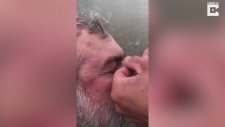 Göz Kapağına Olta Kancası Saplanan Tekne Kaptanı