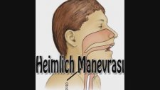 Heimlich Manevrası Nasıl Uygulanır?