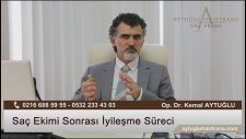 Saç Ekimi Sonrası Süreç