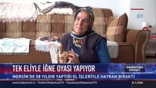 Tek Eliyle İğne Oyası Yapıyor