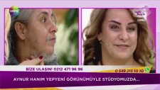 Sakallı Kadın Doğal Görünümüne Kavuştu (Zahide Yetiş)