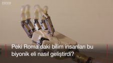 Hisleri iletebilen ilk taşınabilir biyonik el geliştirildi