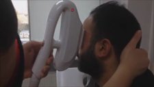 Erkeklerde Yanak Epilasyonu