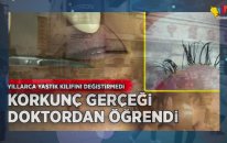 Yastık Kılıfını Yıllarca Değiştirmedi! Kadının Gözlerinden Çıkanlar…