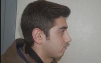 Mustafa Ali Yanık Burunda Şekil Bozukluğu Şikayet İle Başvuran Hastalarının Sonuçlarını Paylaşıyor