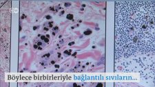 İnsan vücudunda yeni bir organ bulundu: İnterstitiyum - DW Türkçe