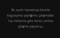 Op Dr Mustafa Ali Yanık Burun Şikayet ve Çözümleri ve Hasta Sonuçları