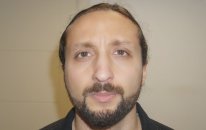Mustafa Ali Yanık burun şikayet ve çözümleri ve hasta sonuçları