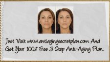 Wrinkles Around Mouth Treatment