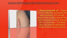 Wart and Mole Vanish What Is The Best Solution For Wart and Mole Vanish