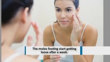Get Rid Skin Tags - The best ways to get rid of Skin Tags