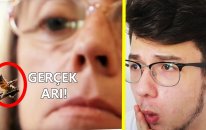 Arı Sokmasına Bağımlı Olan Kadın
