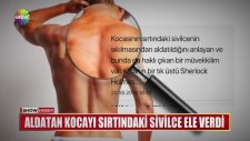 Kocasının Sırtındaki Sivilcelerin Sıkılmasından Aldatıldığını Anlayan Kadın
