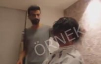 Protez Saç Ne Kadar Dayanır - Protez Saç Modelleri