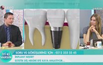 İmplant Hakkında Merak Edilenler