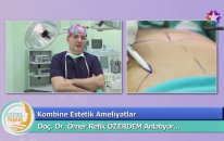 Prof. Dr Ömer Refik Özerdem Ve Op Dr Gökhan Özerdem İle Estetik Cerrahi İstanbul Antalya