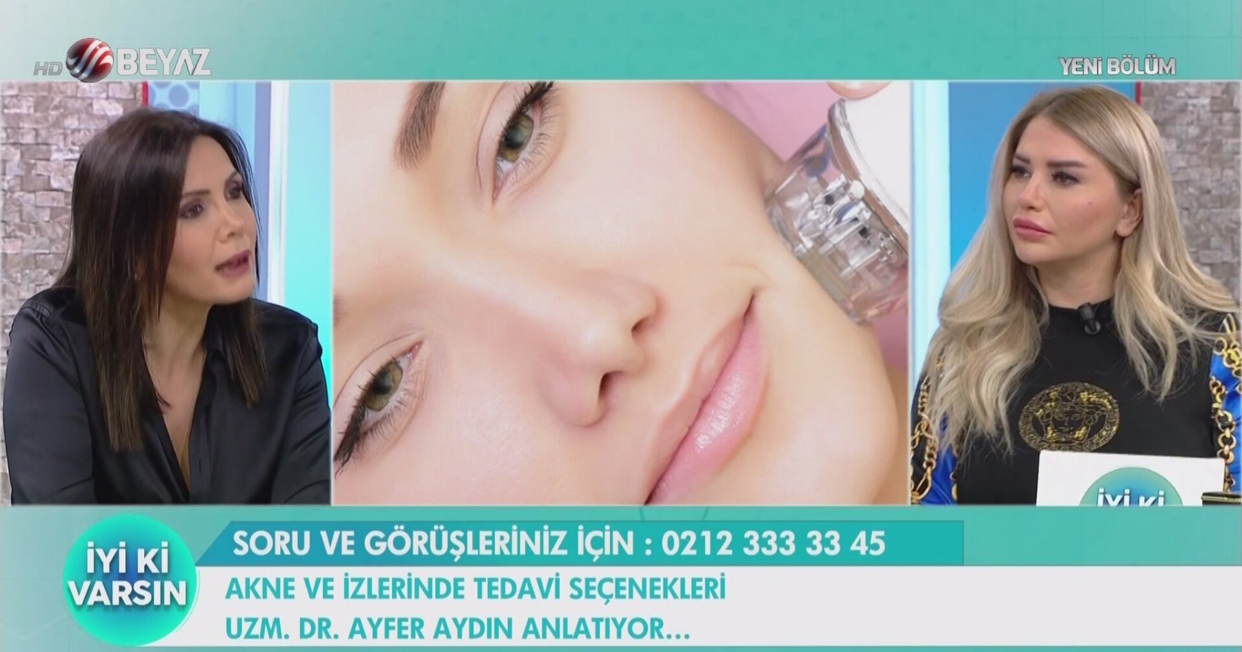 Akne Nedir ve Nasıl Tedavi Edilir Akne Nedir ve Nasıl Tedavi Edilir