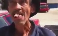 Takma Dişleri İle Şov Yapan Amca