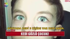 Gece Karanlığında Bile Gündüz Gibi Görebilen Kedi Gözlü Çocuk