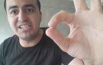 Dudağını Japon Yapıştırıcısı İle Yapıştıran Eleman