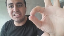 Dudağını Japon Yapıştırıcısı İle Yapıştıran Eleman