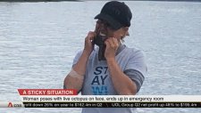Suratına Zehirli Ahtapot Yapıştıran Kadın