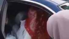 Bilezik Takılmayınca Arabadan İnmeyen Gelin