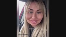Yanlış Botoks Uygulaması Mağduru Olan Rus Kadın