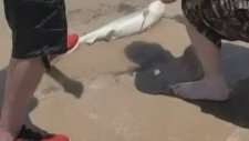 Yavru Köpek Balığı Adamın Bacağını Isırdı