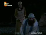 kurşun yarası