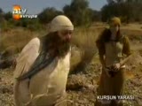 kurşun yarası