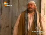 kurşun yarası