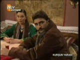 kurşun yarası