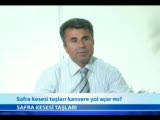 Safra Kesesi Taşları Kansere Yol Açar Mı?