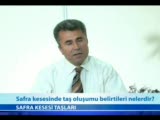 Safra Kesesinde Taş Oluşumu Belirtileri Nelerdir?