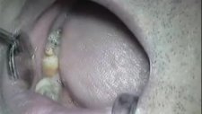 pal kamera