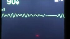 ekg ritimleri1
