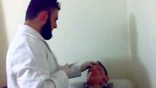 Sülük Tedavi Nasıl Yapılır İzleyin