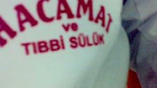 Hacamat Nedir?