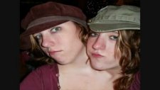 abigail and brittany hensel conjoined twins x