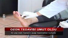 Ozon Tedavisiyle Ayağı Kurtuldu