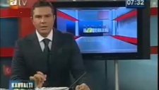 lazer epilasyon nedir nasıl yapılır