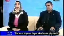 Karımın Muskası Yüzünden Çenem Kaydı (mutfak tupi bitiyor)