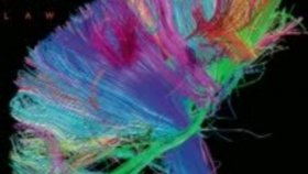 Muse - Supremacy Muse - Supremacy