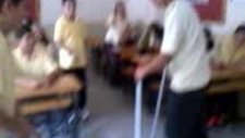 Şaka Yaparken Demir Kafasına Girdi.