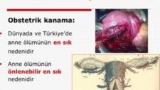 Gebelikte Kanama - Plasenta Previa
