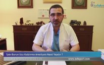 Op Dr Ali Mezdeği : İple Burun Estetiği Ameliyatı