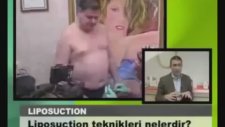 Teoman Doğan : Liposuction Öncesi Ve Sonrası